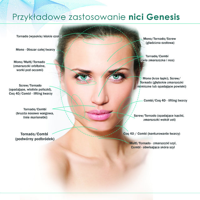 nici-genesis-przykladowe-zastosowanie